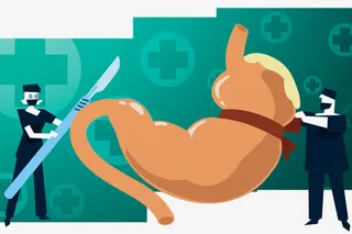 胃部手术插画免抠