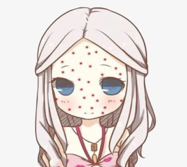 可爱女孩长了满脸痘痘免抠