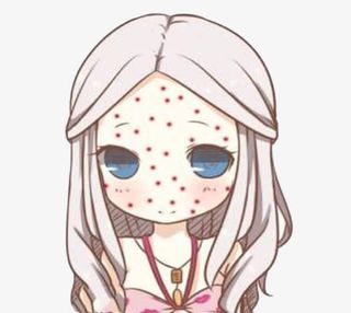 可爱女孩长了满脸痘痘免抠