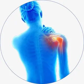 肩周炎疼痛图示png免抠