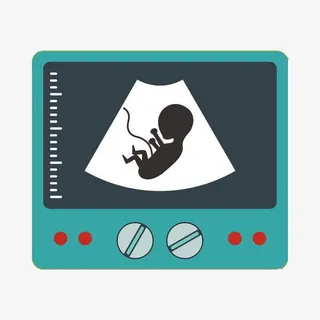 B超显示器上的胎儿免抠