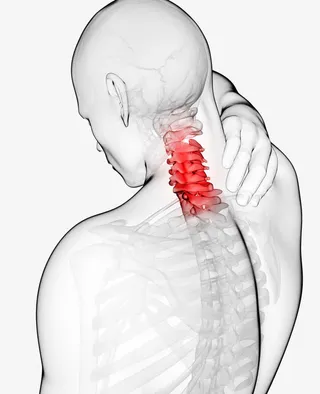 肩周炎图片免抠