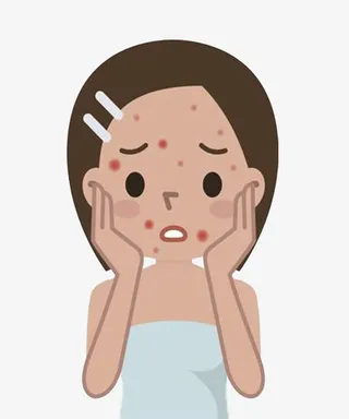 捂着脸痘痘女孩可爱免抠