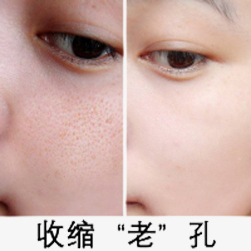毛孔粗大免抠