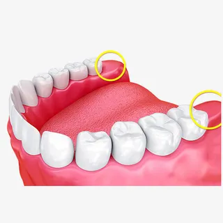 卡通立体口腔智齿插图免抠免抠