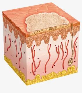 受损的皮肤免抠