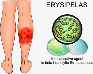 人体腿部受伤形象图免抠