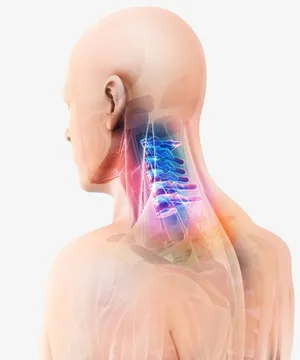 颈椎病脖子疼痛免抠