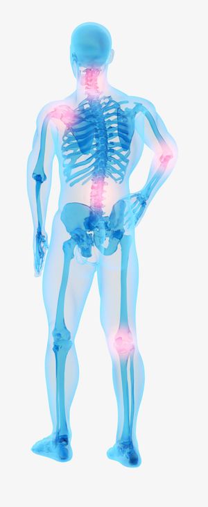 全身X光疼痛免抠