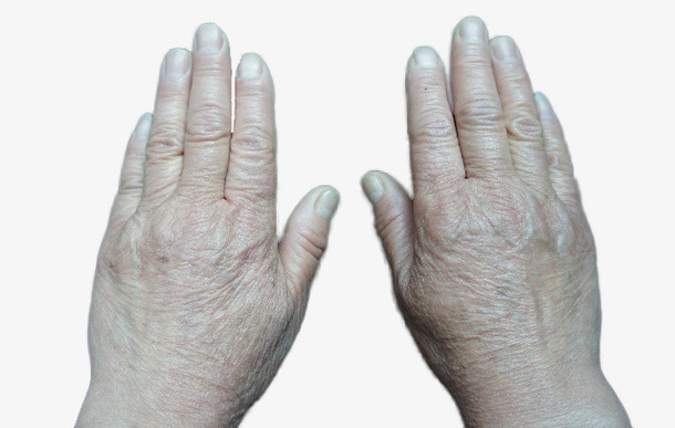 粗糙的双手老人手免抠