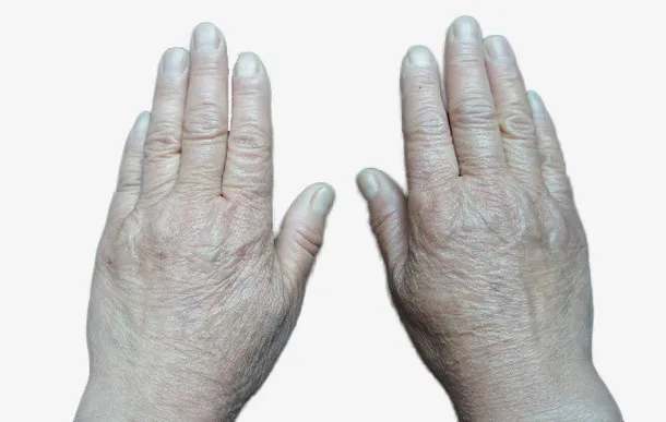 粗糙的双手老人手免抠