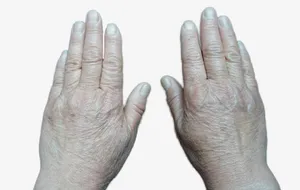 粗糙的双手老人手免抠
