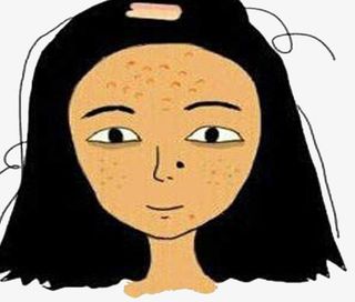 长痘痘女孩黄皮肤憔悴免抠