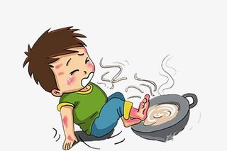 烫伤的男孩免抠