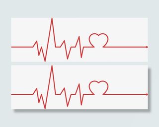 心电图折线免抠