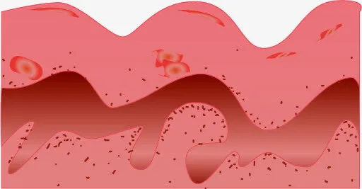 人体皮肤纵切免抠