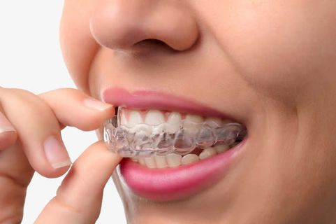 坚固的牙套免抠