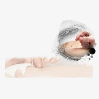 半透明针灸图免抠