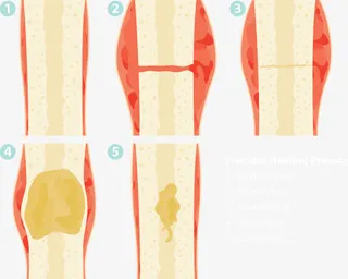 矢量图腿骨免抠