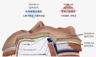 肌肤组织结构图免抠