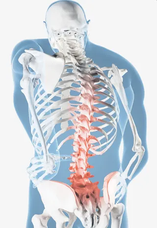 人体腰椎骨炎症免抠