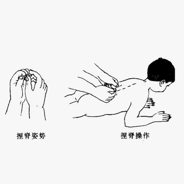小儿推拿捏脊免抠