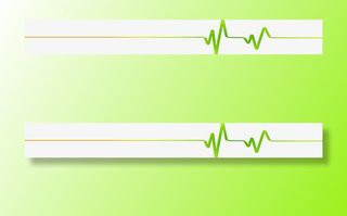 绿色卡通心电图医疗免抠