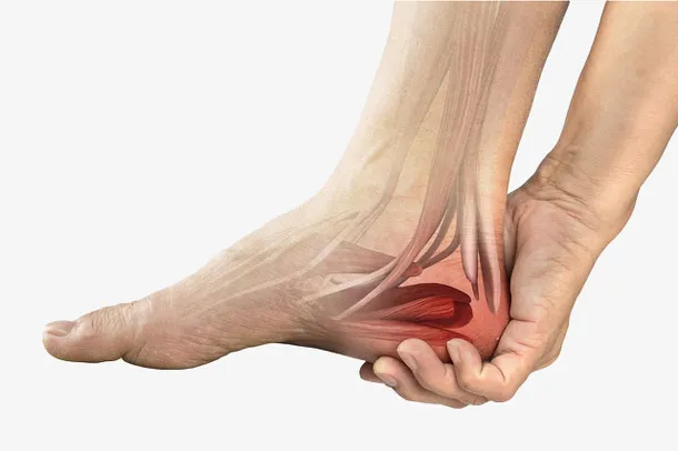 脚后跟疼脚麻腱鞘炎免抠