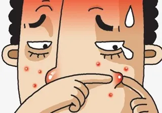 挤痘痘的男人皱眉免抠