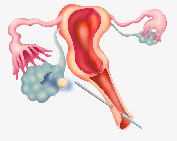 生殖系统医疗插图免抠