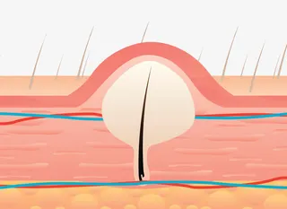 皮脂结构医学插图免抠