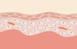 皮肤纹理结构免抠