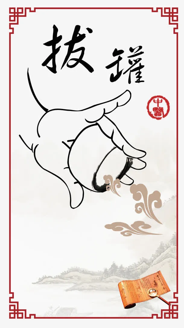 拔罐图免抠