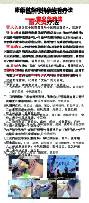 雷火灸展架图片