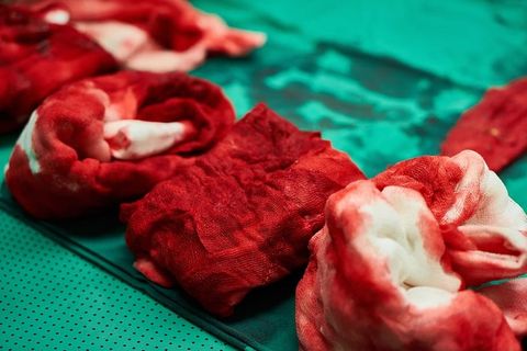 外科、医院、医生、手术、护士、团队合作、工作、绿色