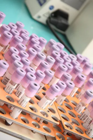 实验室、分析、健康、室内、特写、高角度视图、无人、医疗和医学