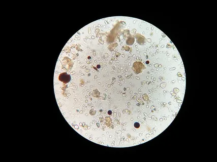 显微图像,土壤微生物,显微镜,土壤样本,科学,黑色背景,生物学,圆圈 显微图像,土壤微生物,显微镜,土壤样本,科学,黑色背景,生物学,圆圈