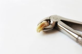 牙齿，牙医，磨牙，智齿，拔牙，拔牙，钳子，zahnarztpraxis