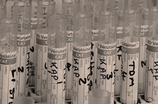 浅色，聚焦照片，透明，玻璃试管，试管，试管，实验室，医疗