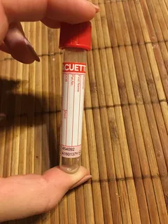 血液，试管，下载，实验室，测试，诊断，诊断，医学