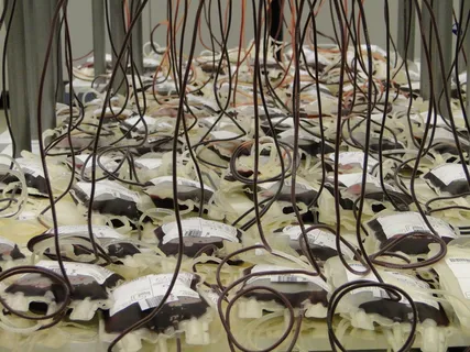 包, 血袋, 袋子, 红细胞, 红色, 献血者, 自行车, 大组物体