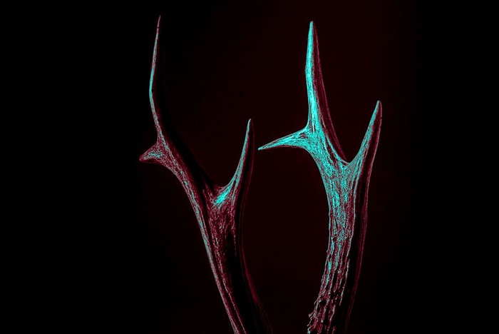 黑色、角形、锐利、黑色背景、医疗保健和医学、、摄影棚拍摄、解剖学