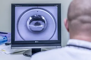 选择性、聚焦摄影、打开lg、监视器）、mri、磁共振成像、诊断、医院
