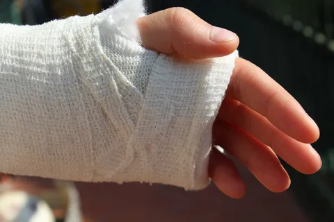 骨科,绷带,手,粉笔,医院,骨折,扭伤,受伤 骨科,绷带,手,粉笔,医院,骨折,扭伤,受伤