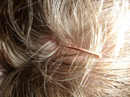 人发, 针灸, 针灸针, 头皮, 针头, 头, 头发, 保佑你