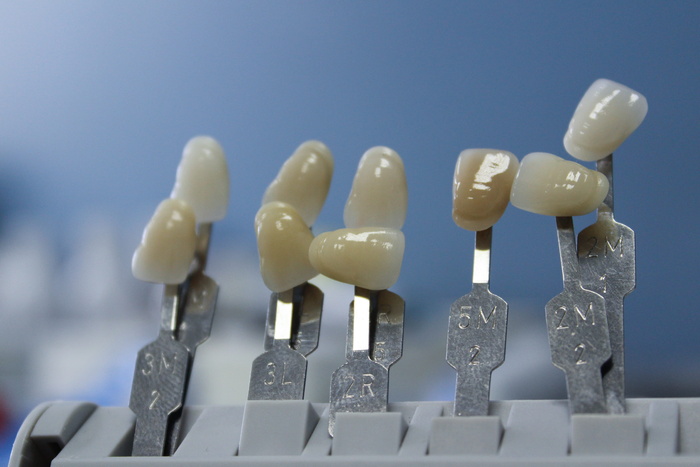 选择性的, focus photography, key, rack, Tooth, Dentist, Dental, Health, Health, Care