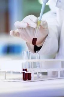 倾斜镜头摄影,透明,玻璃试管,红色,液体,内部,科学,科学家 倾斜镜头摄影,透明,玻璃试管,红色,液体,内部,科学,科学家