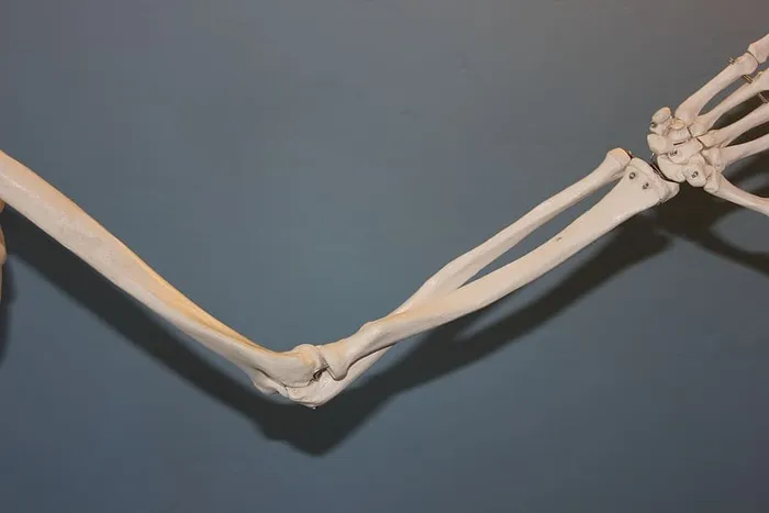 特写，照片，人类，骨骼手臂，骨骼，肘部，解剖学，身体