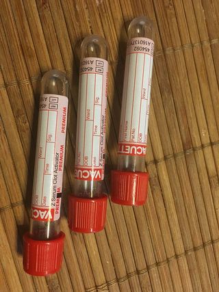 试管，下载，血液，实验室，测试，诊断，医院，医疗