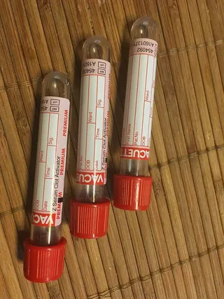 试管，下载，血液，实验室，测试，诊断，医院，医疗